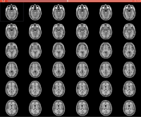 Slicer4DataLoading tutorial.png