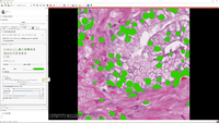 SlicerPathologyScreenShot8.png
