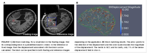 Liu-FrontNeuroinform2014-fig1.png